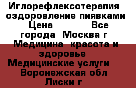 Иглорефлексотерапия, оздоровление пиявками › Цена ­ 3 000 - Все города, Москва г. Медицина, красота и здоровье » Медицинские услуги   . Воронежская обл.,Лиски г.